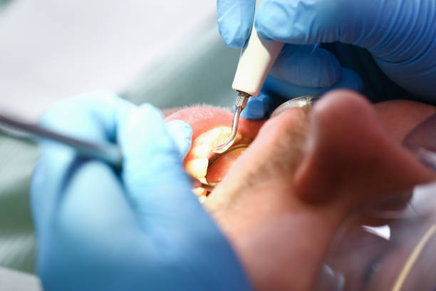 Best Emergency Dental Services for Seniors in Sycamore, IL