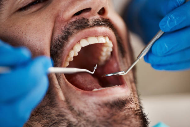 Best Emergency Dentist for Knocked-Out Tooth in Sycamore, IL